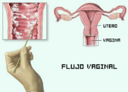 Flujo vaginal.png
