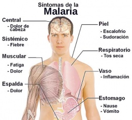 Síntomas de la Malaria.JPG