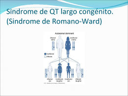 Síndrome de Romano Ward.jpg