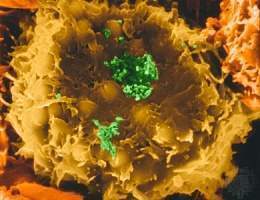 Virus linfotrópico.jpg