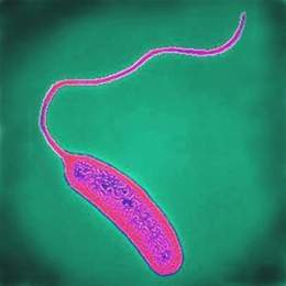 Vibrio cholerae (Large).jpg