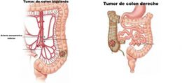 Th 3876colectomiaoncologica (1).jpg