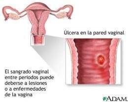Vagina 1.jpg